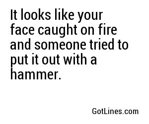 It looks like your face caught on fire and someone tried to put it out with a hammer.